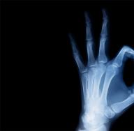 The difference between x-ray and fluorography